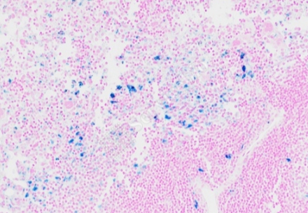 普魯士藍染色（含鐵血黃素）主圖