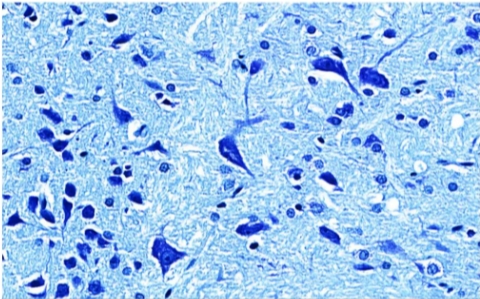 尼氏染色 (尼氏小體)主圖