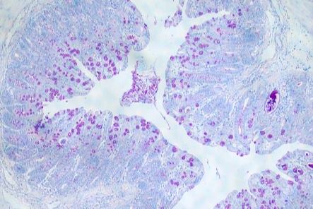 PAS染色(中性粘液和杯狀細(xì)胞)主圖